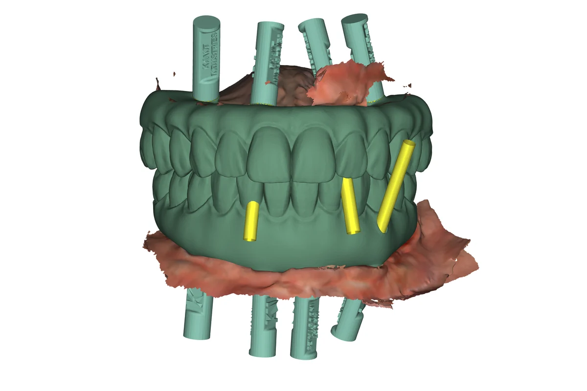 Restoration