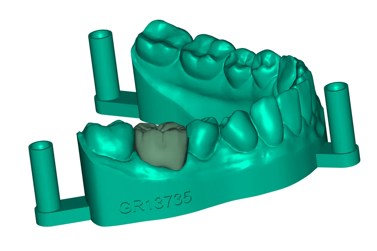 Restoration QA example 1